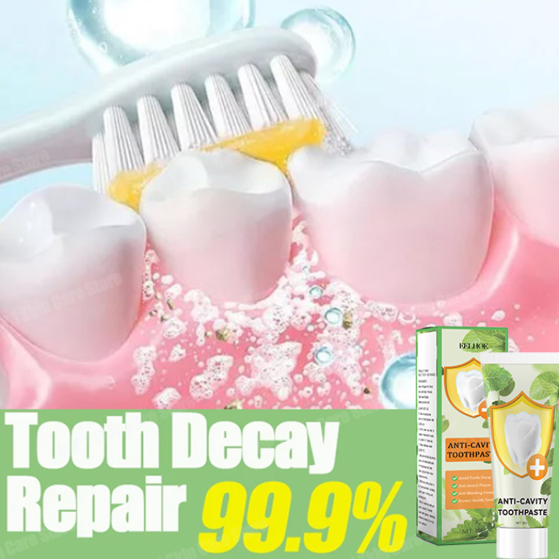 Teeth Whitening Cream - Anti Decay Toothpaste repairs cavities, removes