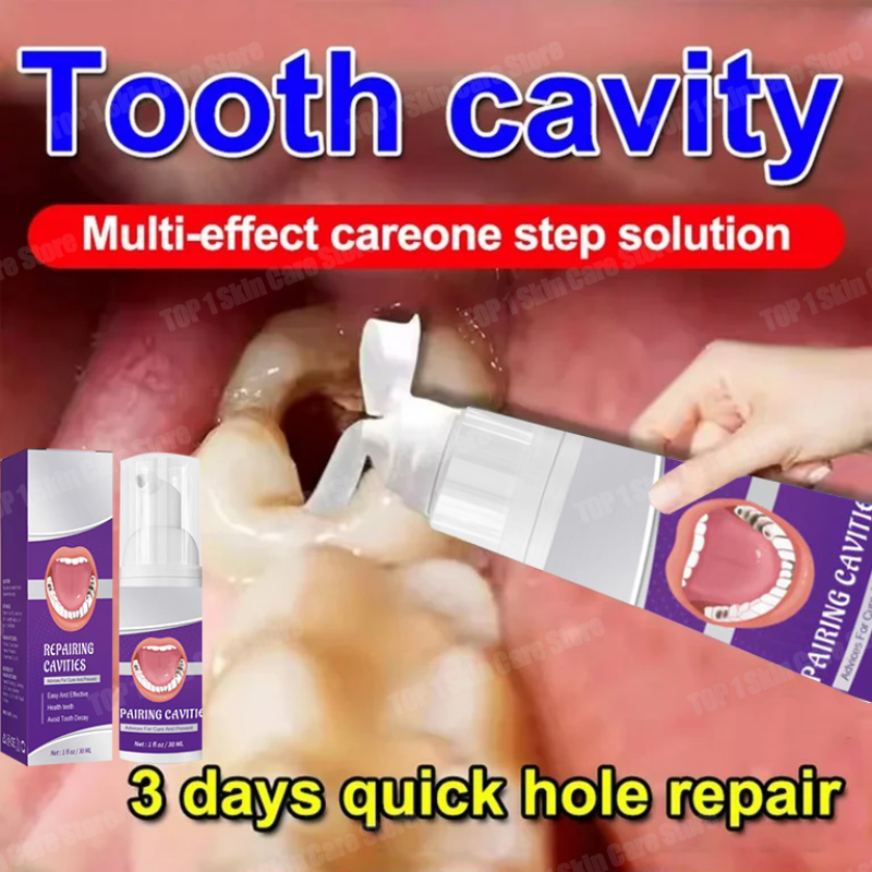 Teeth Whitening Cream - Hot sales Best-selling, Scientific Repairs Cavities,