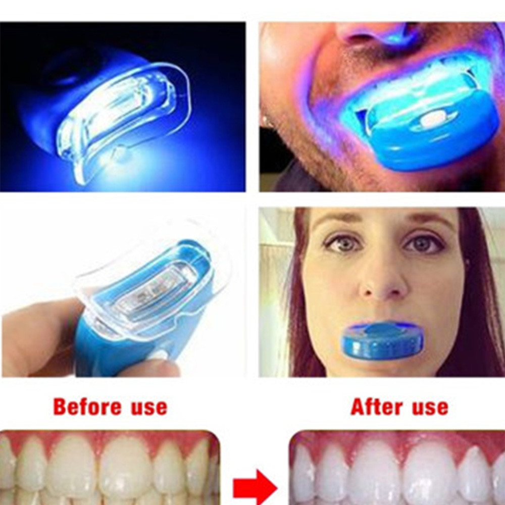 LED Teeth Whitening Light Whit - огляд і ціна Teeth Whitening Laser Treatment
