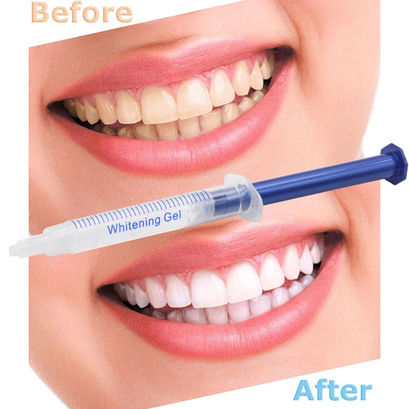 20 pcs Teeth Whitening gels De - огляд і ціна Teeth Whitening Kit With Light