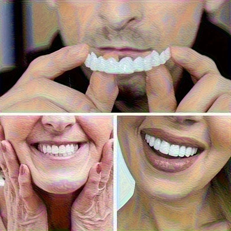 Uneven Teeth Fix Teeth Veneers - огляд і ціна Teeth Whitening Uneven