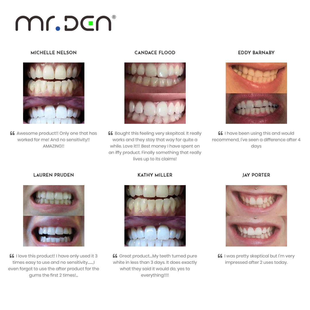 Dr. Whiten 3 Pack Teeth Whiten - огляд і ціна Teeth Whitening Kit With Light