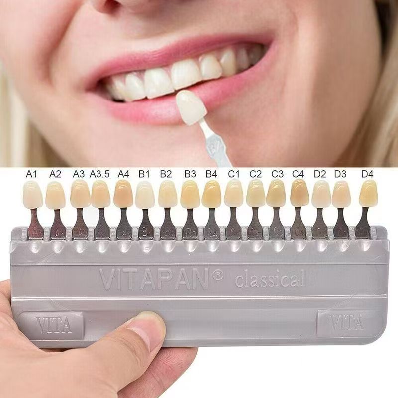 VITA 16 Colors Teeth Shade Gui - огляд і ціна Teeth Whitening Professional