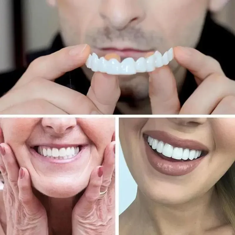Charming Smile Teeth Veneers,  - огляд і ціна Teeth Whitening Uneven