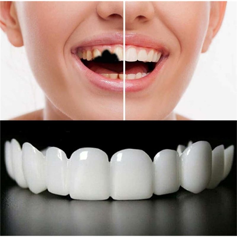 Reusable Temporary False Teeth - огляд і ціна Teeth Whitening Uneven