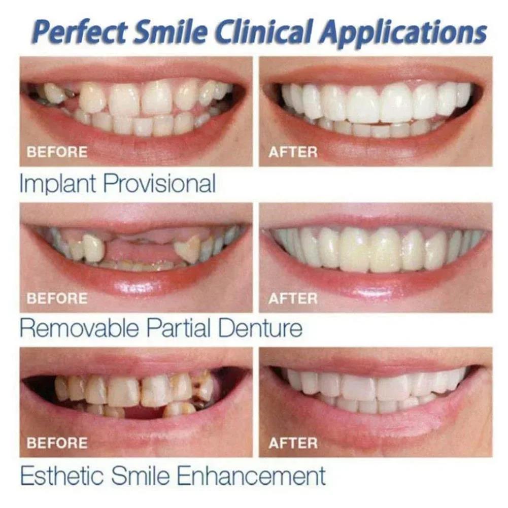 Best Sellers  Teeth Kit Fake T - огляд і ціна Teeth Whitening Kit