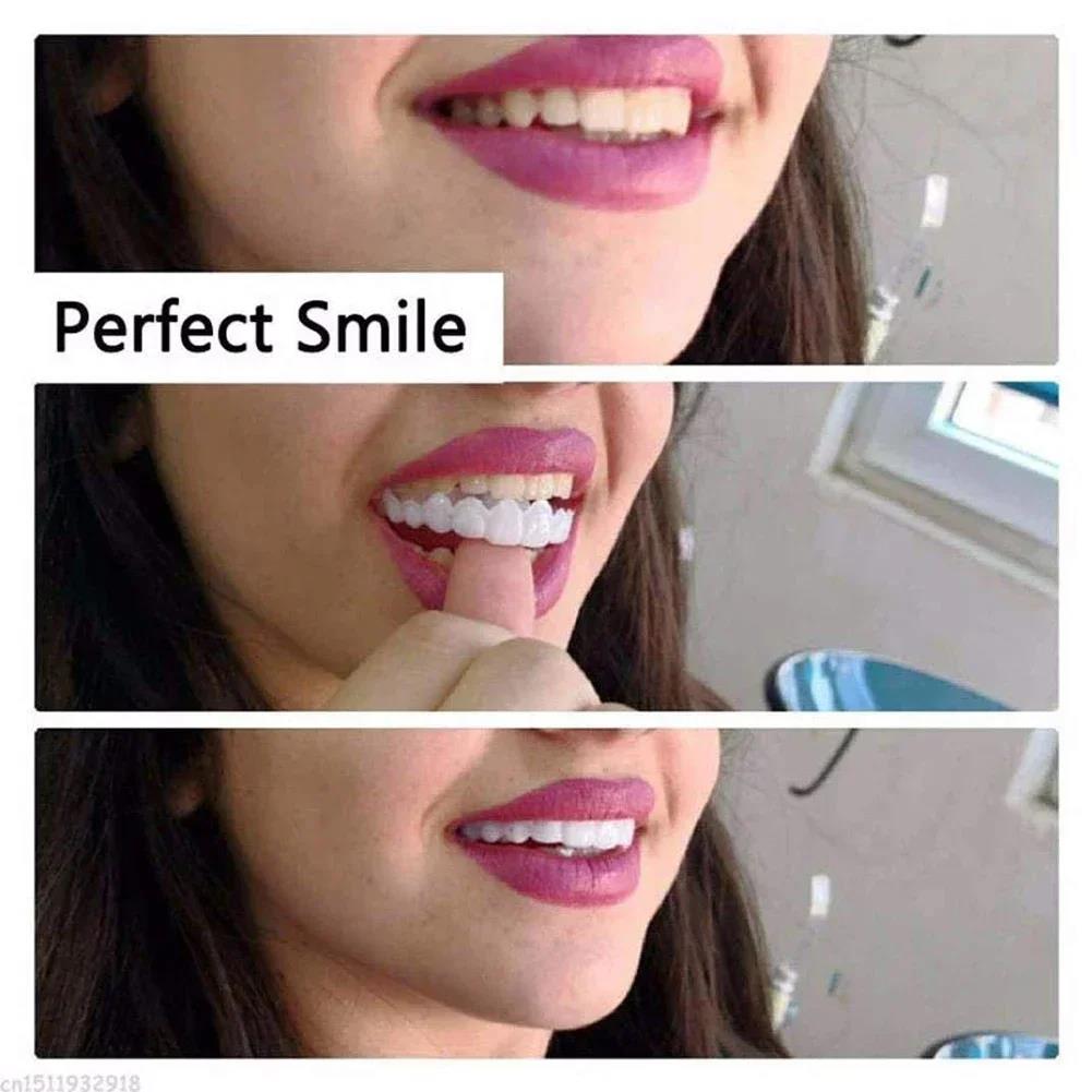 Best Sellers  Teeth Kit Fake T - огляд і ціна Teeth Whitening Kit