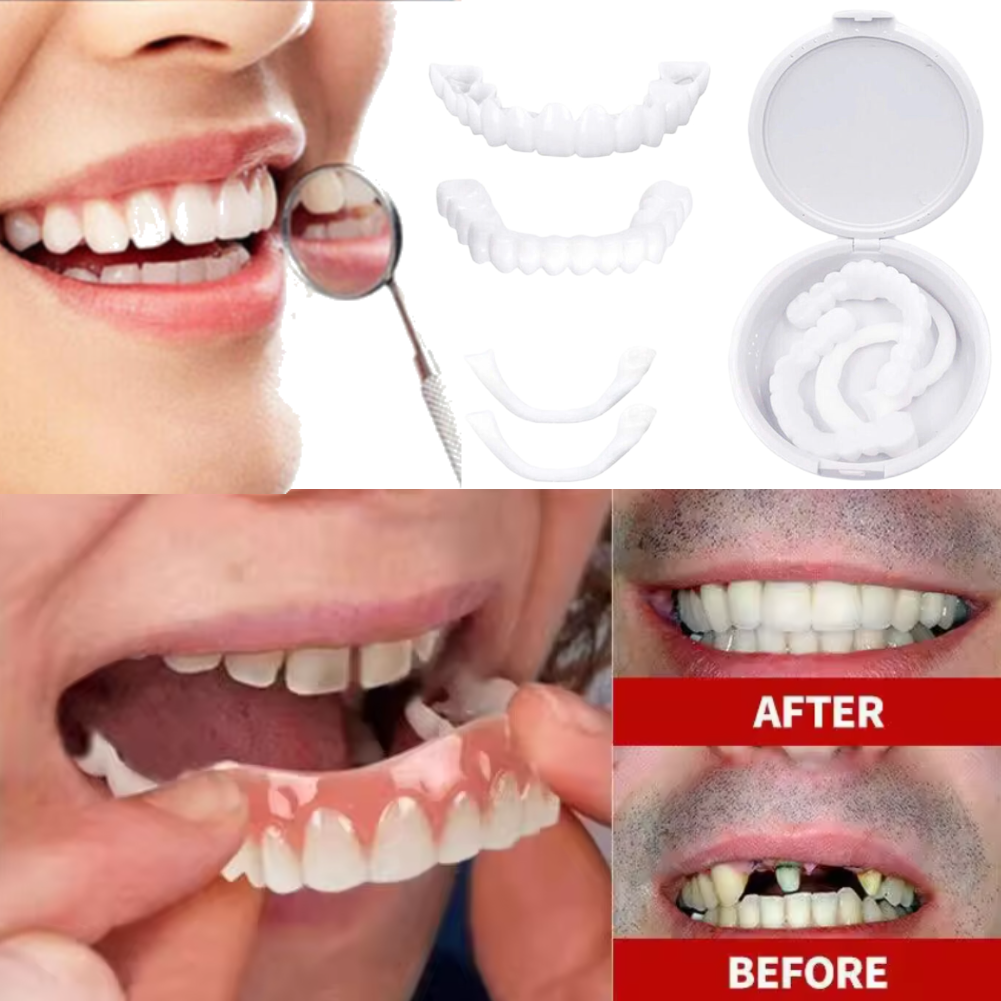 Charming Smile Teeth Veneers,  - огляд і ціна Teeth Whitening Uneven