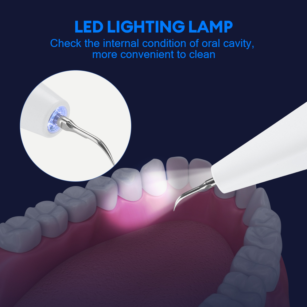 Ultrasonic Dental Calculus Rem - огляд і ціна Teeth Whitening Kit