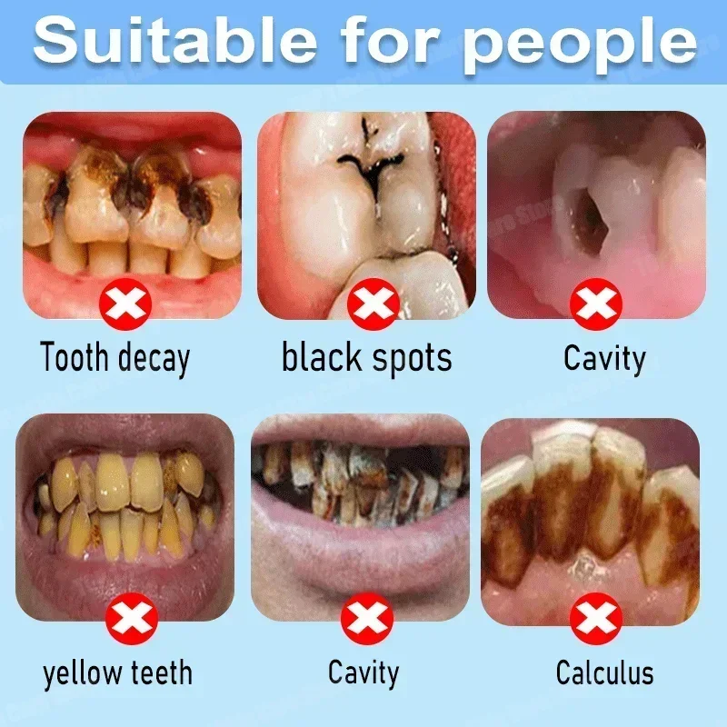 Anti Decay Toothpaste repairs  - огляд і ціна Teeth Whitening Cream