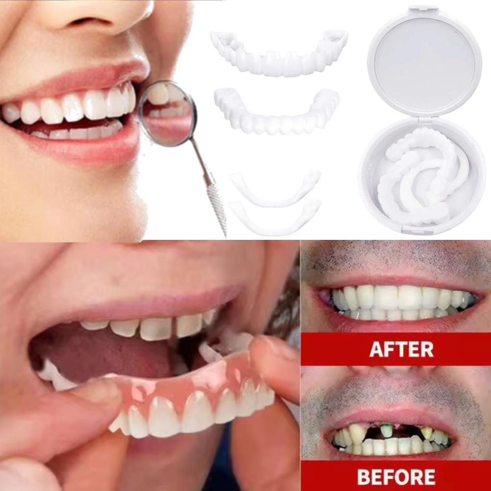 New Charming Smile Teeth Venee - огляд і ціна Teeth Whitening Uneven