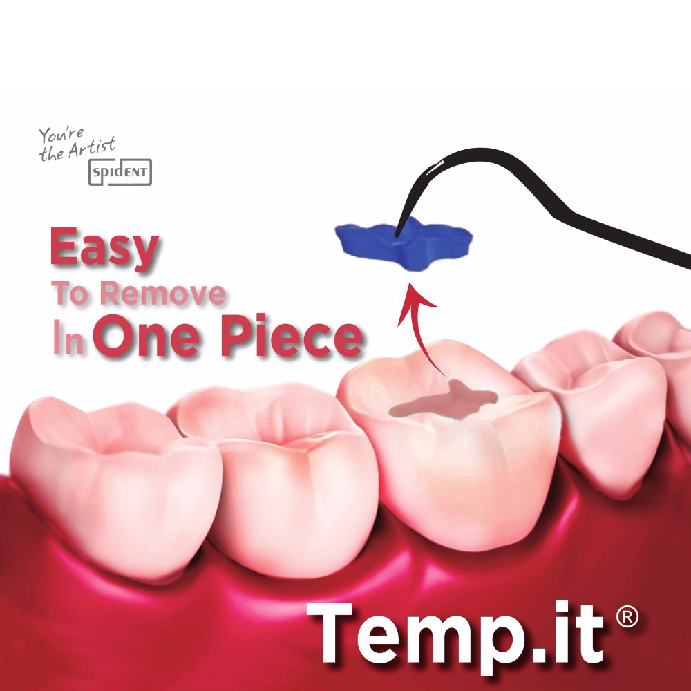 3gx3pcs Spident Temp It Dental - огляд і ціна Teeth Whitening Opalescence