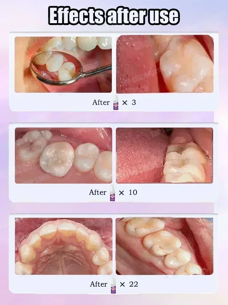 Hot sales Best-selling, Scient - огляд і ціна Teeth Whitening Cream