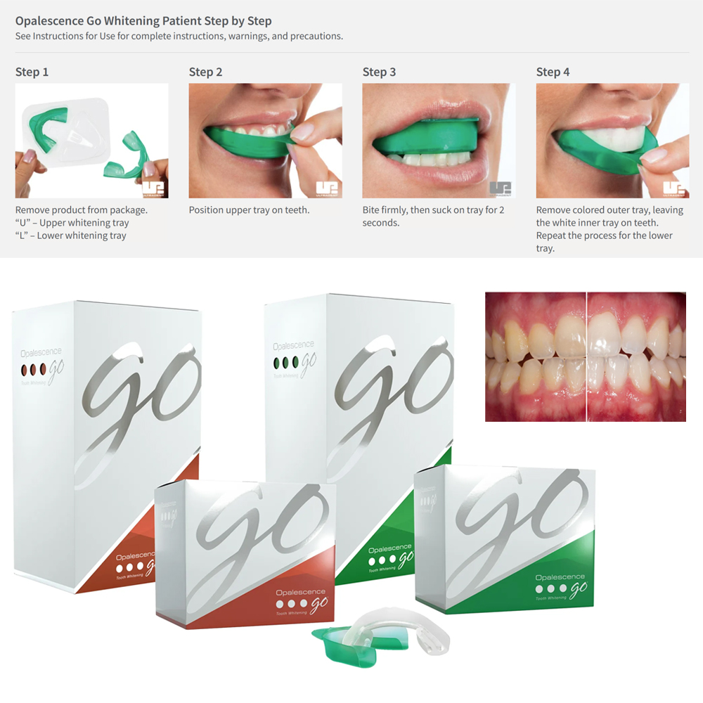 Opalescence Go Teeth Whitening - огляд і ціна Teeth Whitening Opalescence