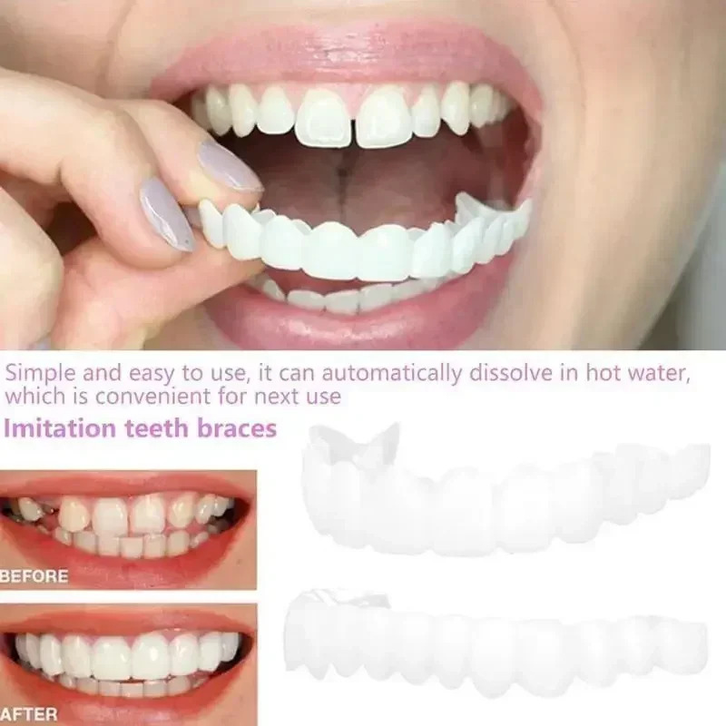 Charming Smile Teeth Veneers,  - огляд і ціна Teeth Whitening Uneven