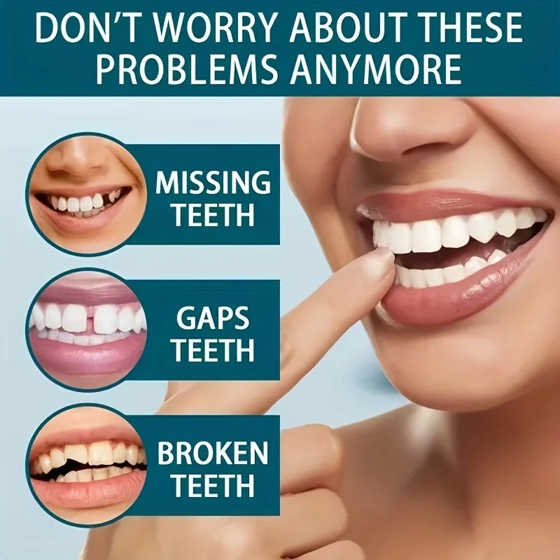 New Uneven Teeth Fix Veneers R - огляд і ціна Teeth Whitening Uneven