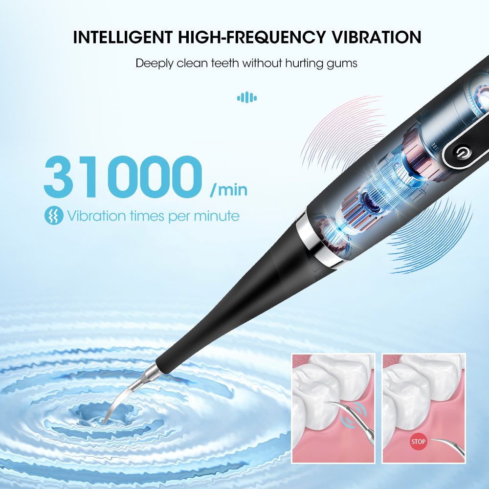 Portable Electric Sonic Dental - огляд і ціна Teeth Whitening Kit