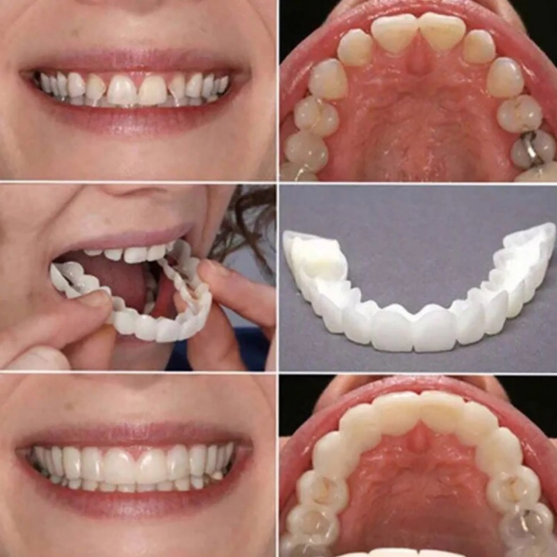 Reusable Temporary False Teeth - огляд і ціна Teeth Whitening Uneven