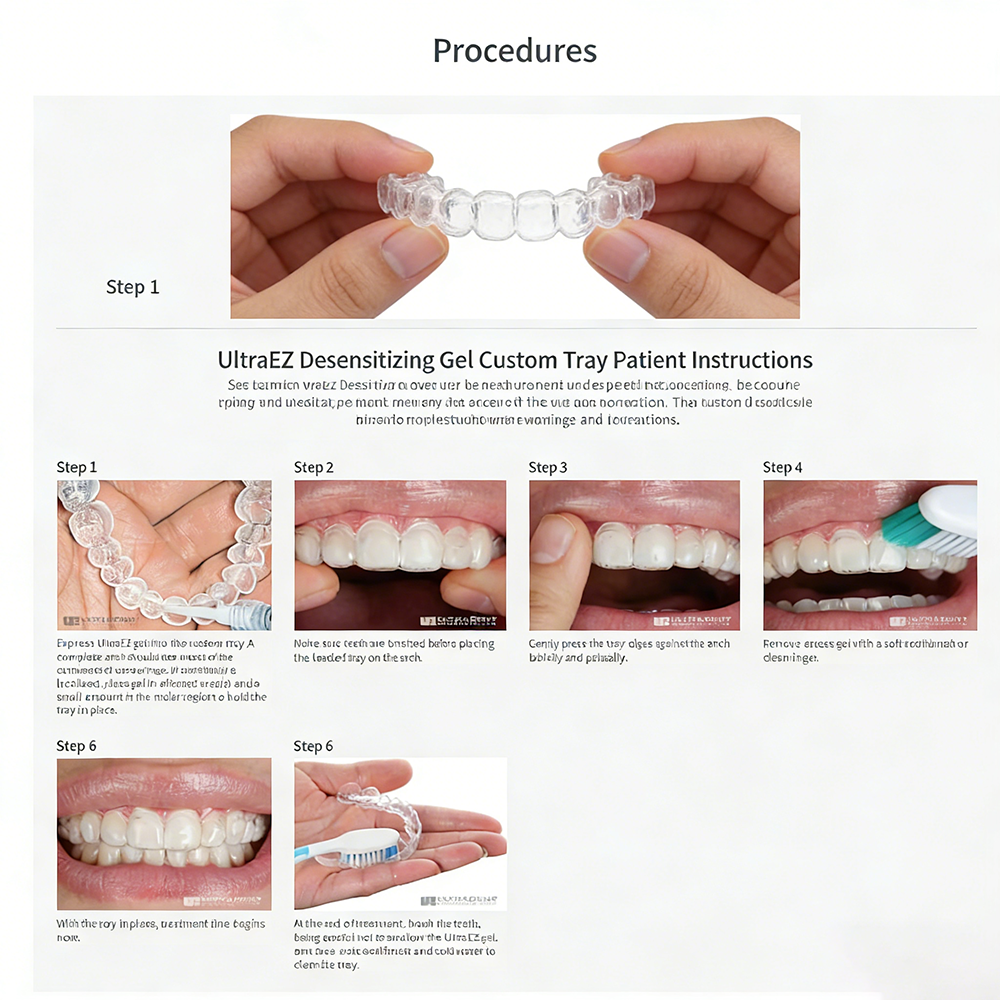Ultra Ez Dental Desensitizing  - огляд і ціна Teeth Whitening Opalescence