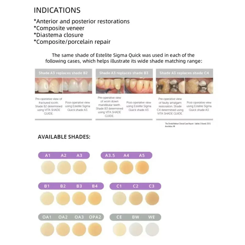 Dental UV Curable Resin Tokuya - огляд і ціна Teeth Whitening Opalescence