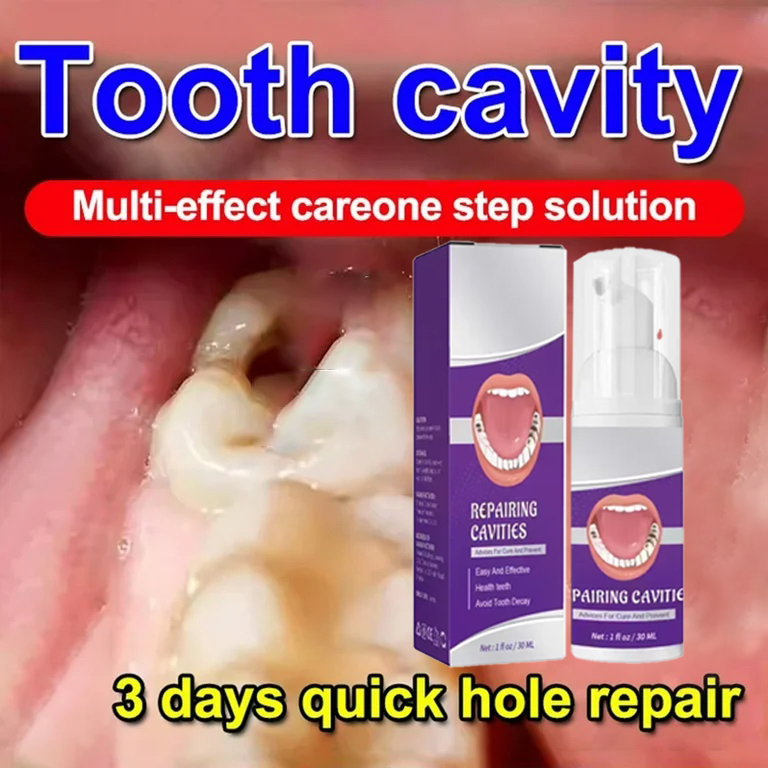 Teeth Cleaning Toothpaste Remo - огляд і ціна Teeth Whitening Cream