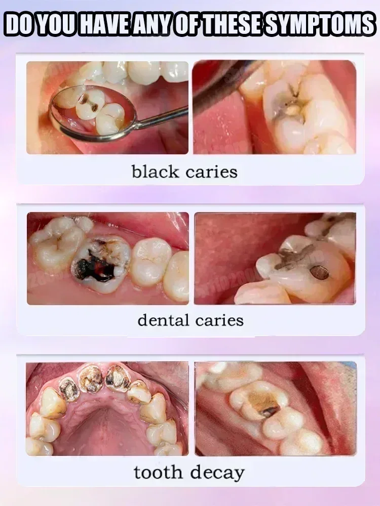 Teeth Cleaning Toothpaste Remo - огляд і ціна Teeth Whitening Cream