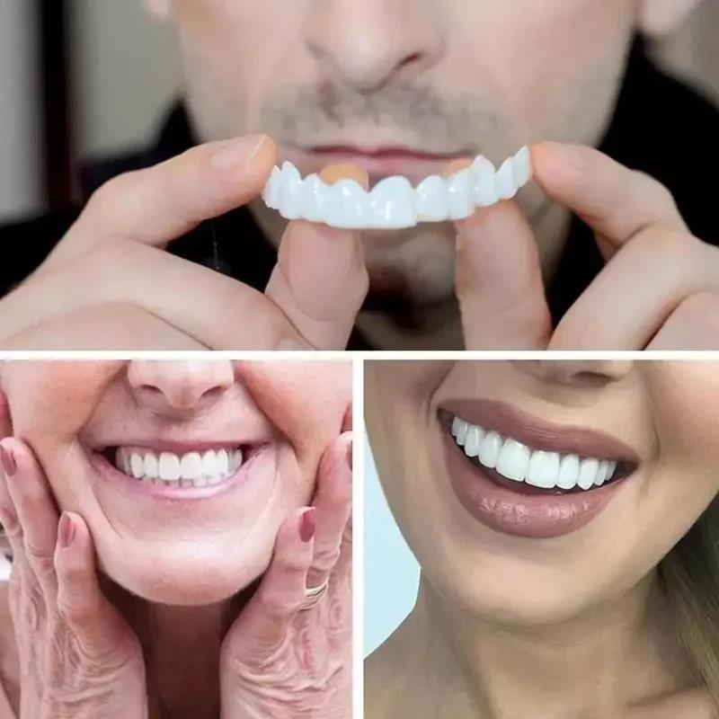 New Charming Smile Teeth Venee - огляд і ціна Teeth Whitening Uneven