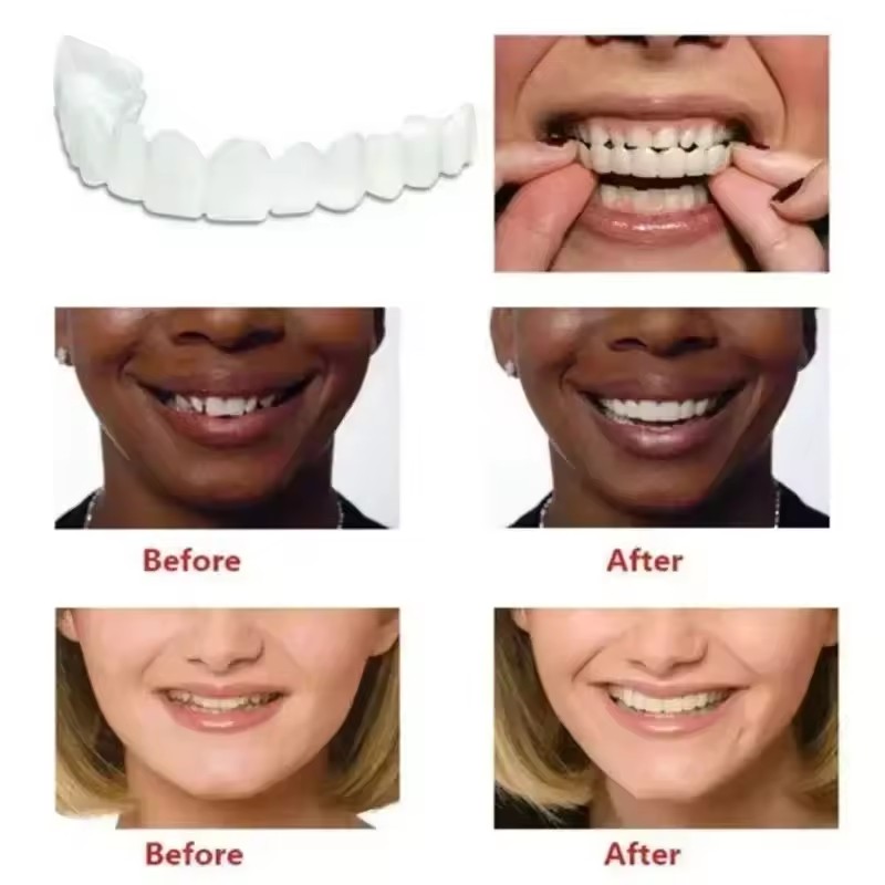 New Reusable Temporary False T - огляд і ціна Teeth Whitening Uneven