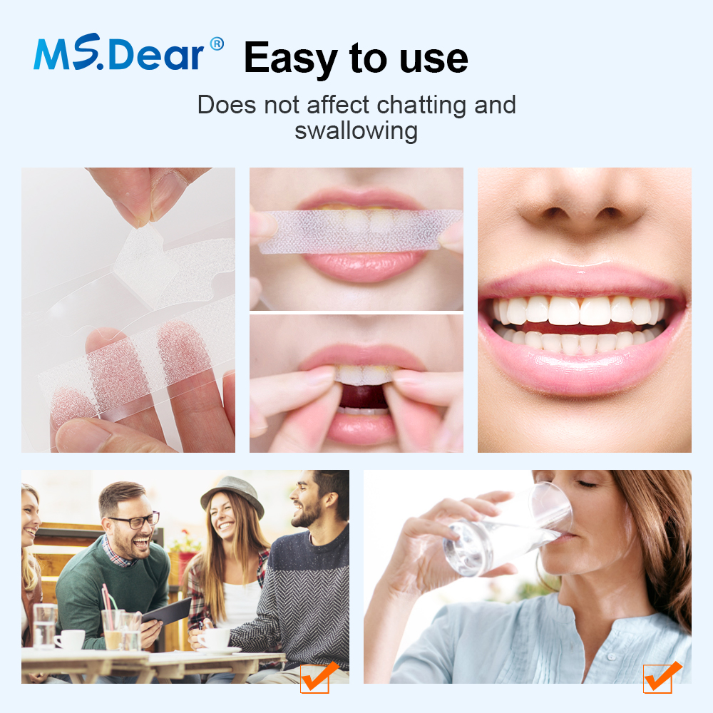 Teeth Whitening Strips Cleansi - огляд і ціна Teeth Whitening Cream
